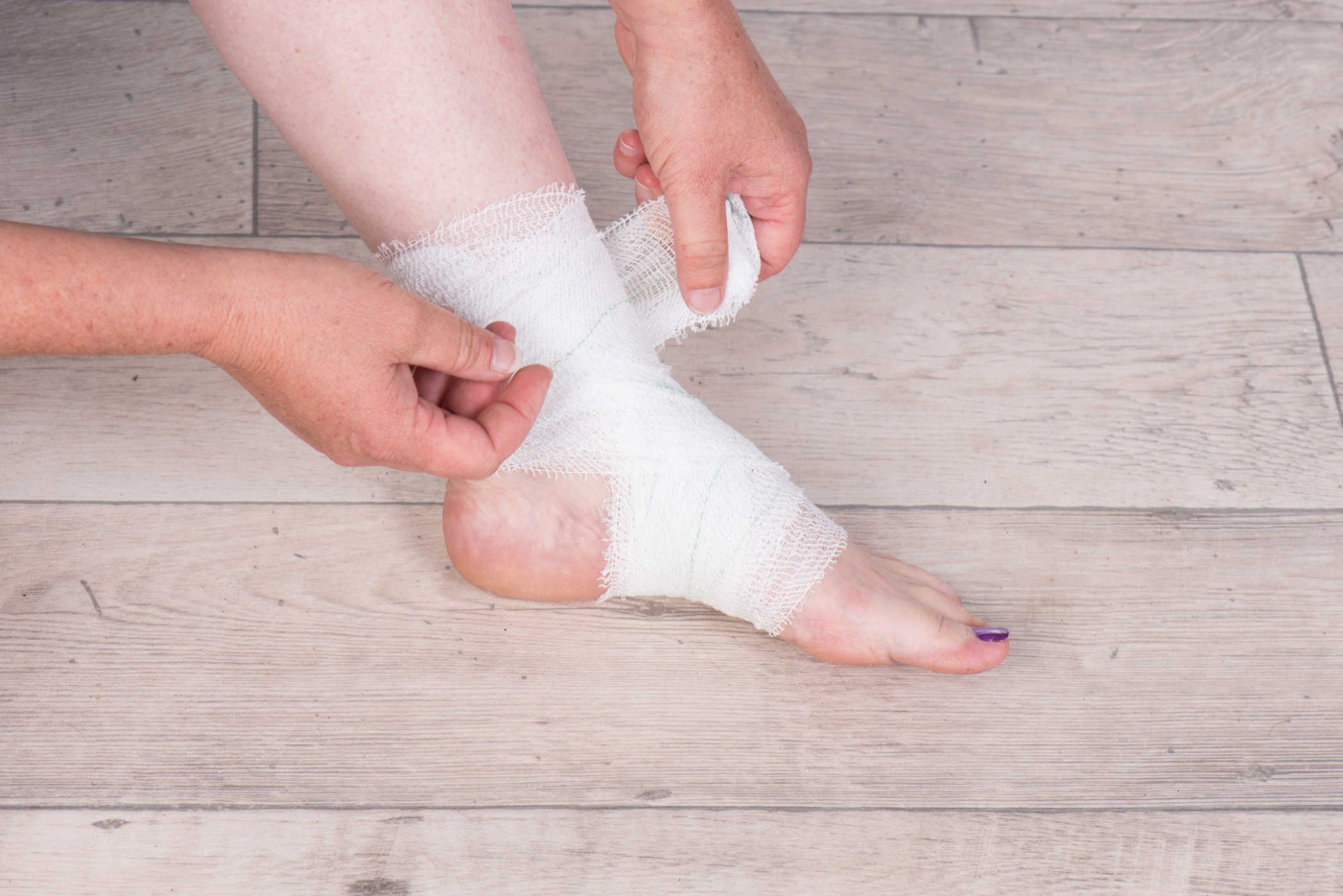 Diabetic Foot (ဆီးချိုကြောင့်ဖြစ်သော ခြေထောက်အနာ)