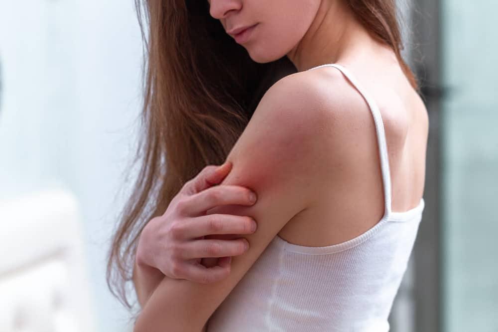 ဆိုရီရေးစစ် (Psoriasis) ကို ကုသသော လိမ်းဆေး၊သောက်ဆေး၊ထိုးဆေးများ။