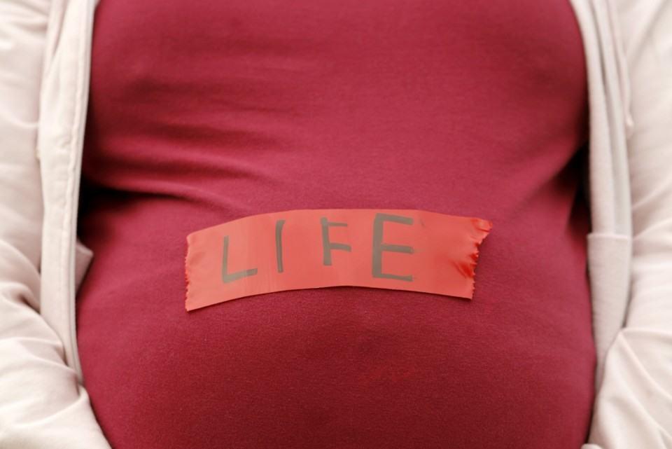Abortion (ကိုယ်ဝန်ဖျက်ချခြင်း)