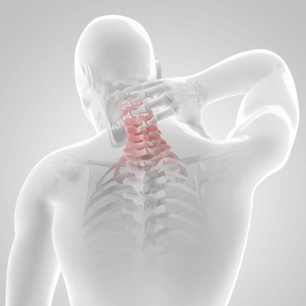 Cervical Disc (áááşáááşá¸áĄáá
áşááźáŹá¸áĄááťááşááźáŹá¸)