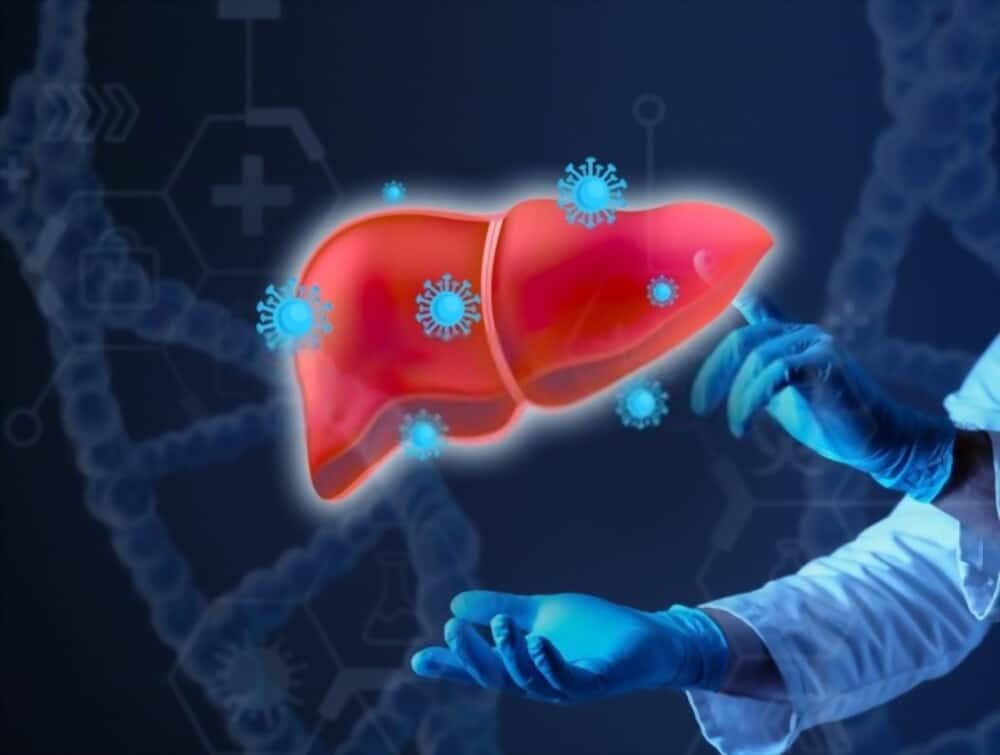 Hepatitis A (အသည်းရောင်အသားဝါ အေ ရောဂါ)