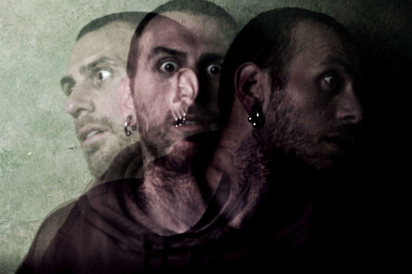 Schizophrenia (စိတ်ကစဉ့်ကလျားရောဂါ)