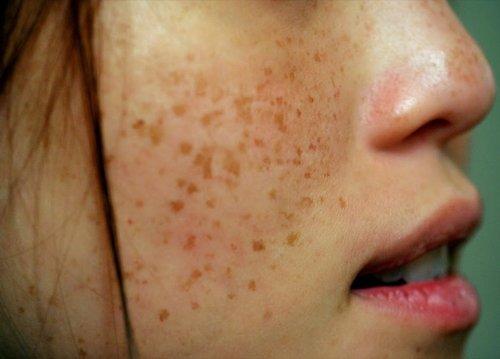 %e1%80%a1%e1%80%9e%e1%80%80%e1%80%b9%e1%80%9b%e1%80%9c%e1%80%ac%e1%80%9c%e1%80%bd%e1%80%ba%e1%80%84%e1%80%b9-%e1%80%bb%e1%80%96%e1%80%85%e1%80%b9%e1%80%b1%e1%80%95%e1%81%9a%e1%80%9c%e1%80%ac%e1%80%9e