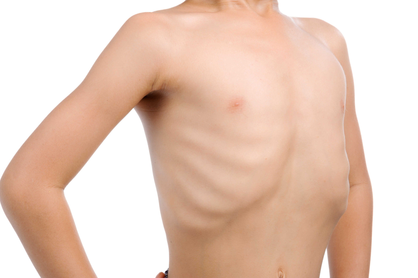 Malnutrition (áĄáŹááŹá áááźááˇáşáááźááşá¸ )
