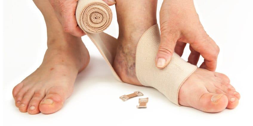 Venous skin ulcer (သွေးပြန်ကြောကြောင့်ဖြစ်သော ခြေထောက်ပြည်တည်နာ)