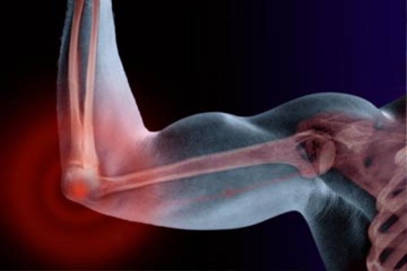 nursemaids-elbow-%e1%80%90%e1%80%b6%e1%80%90%e1%80%b1%e1%80%ac%e1%80%84%e1%80%ba%e1%80%86%e1%80%85%e1%80%ba-%e1%80%a1%e1%80%9b%e1%80%ad%e1%80%af%e1%80%b8%e1%80%9c%e1%80%bd%e1%80%b2%e1%80%81%e1%80%bc