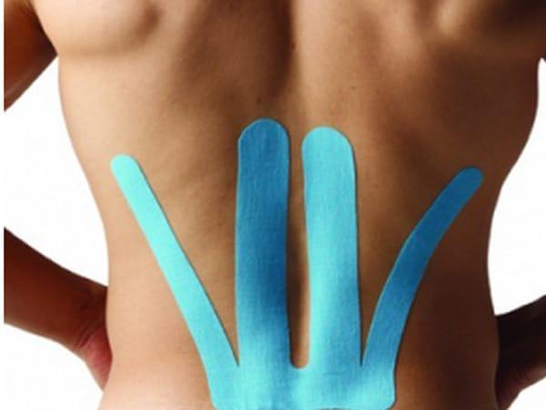 ခါးနဲ့ တင်ပါးတဝိုက်နာကျင်ခြင်းတွေအတွက် kinesiology တိပ်