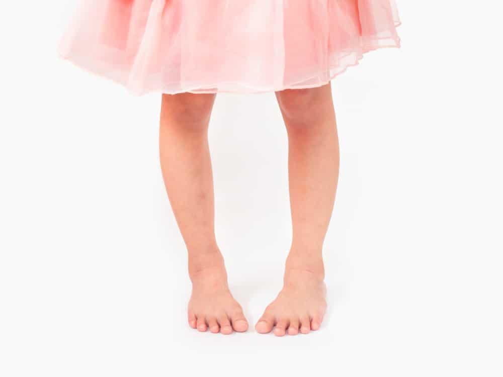 rickets-%e1%80%a1%e1%80%9b%e1%80%ad%e1%80%af%e1%80%b8%e1%80%b1%e1%80%95%e1%80%ba%e1%80%ac%e1%80%b7%e1%80%9e%e1%80%b0%e1%80%84%e1%80%9a%e1%80%b9%e1%80%94%e1%80%ac