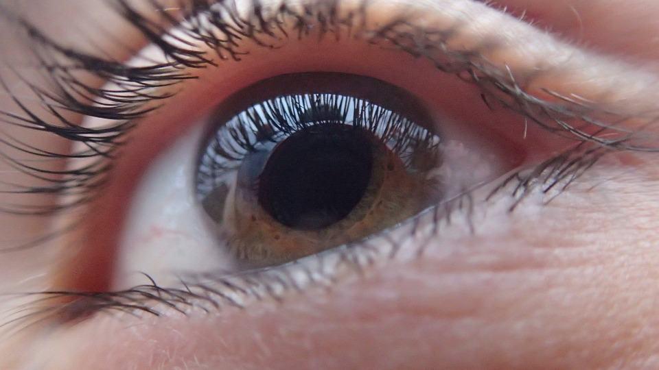 Glaucoma Surgery (ááťááşá
áááąááááş áá˝á˛á
áááşááŻáááźááşá¸)