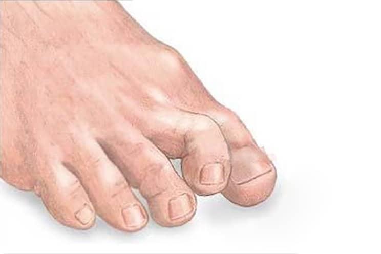 %e1%80%b1%e1%80%99%e1%80%ac%e1%80%90%e1%80%94%e1%80%b9%e1%80%85%e1%80%b9%e1%80%94%e1%80%b0%e1%80%9b%e1%80%ad%e1%80%af%e1%80%b8%e1%80%99%e1%80%ac%e1%80%b8