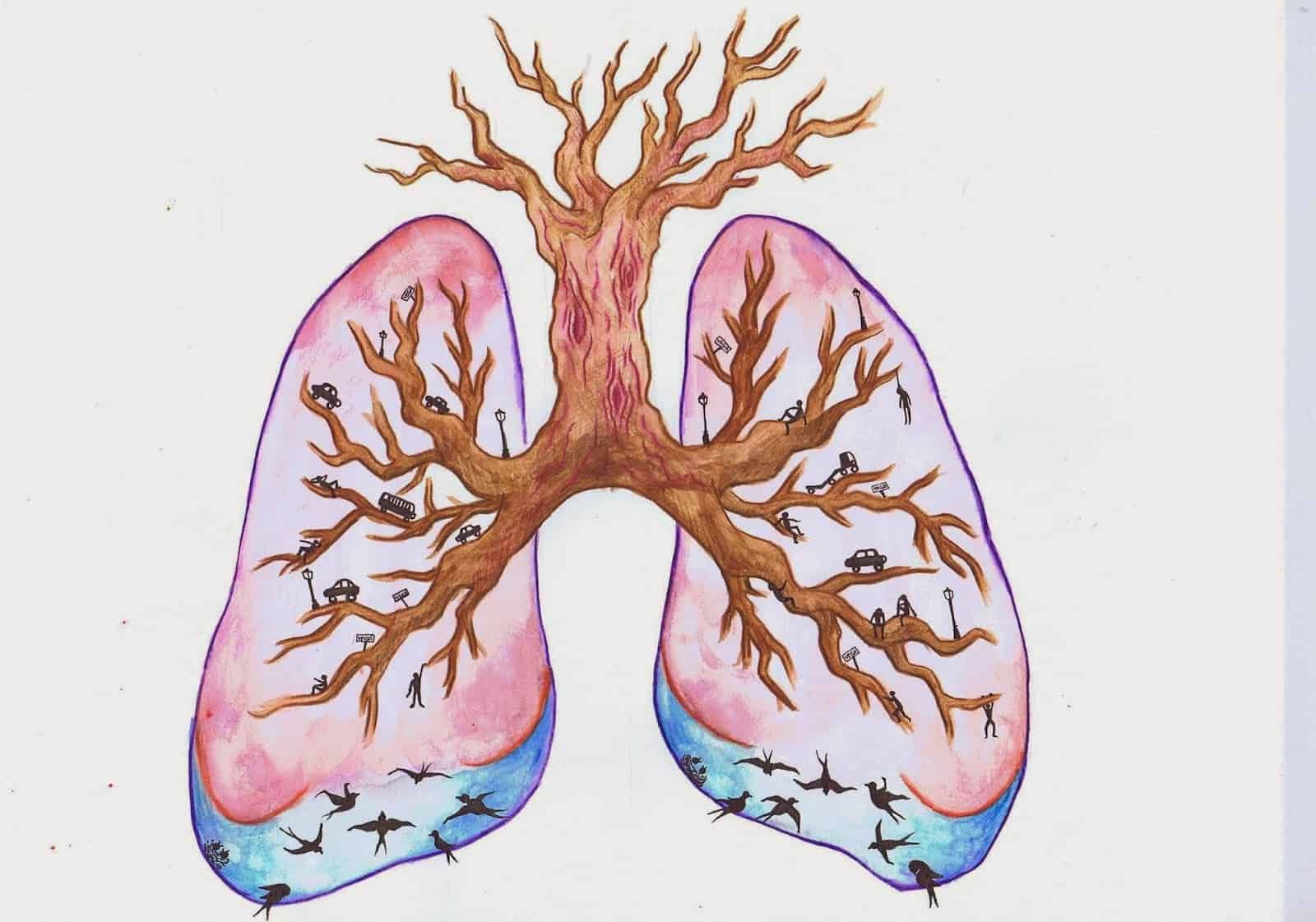 pathophysiology-of-copd
