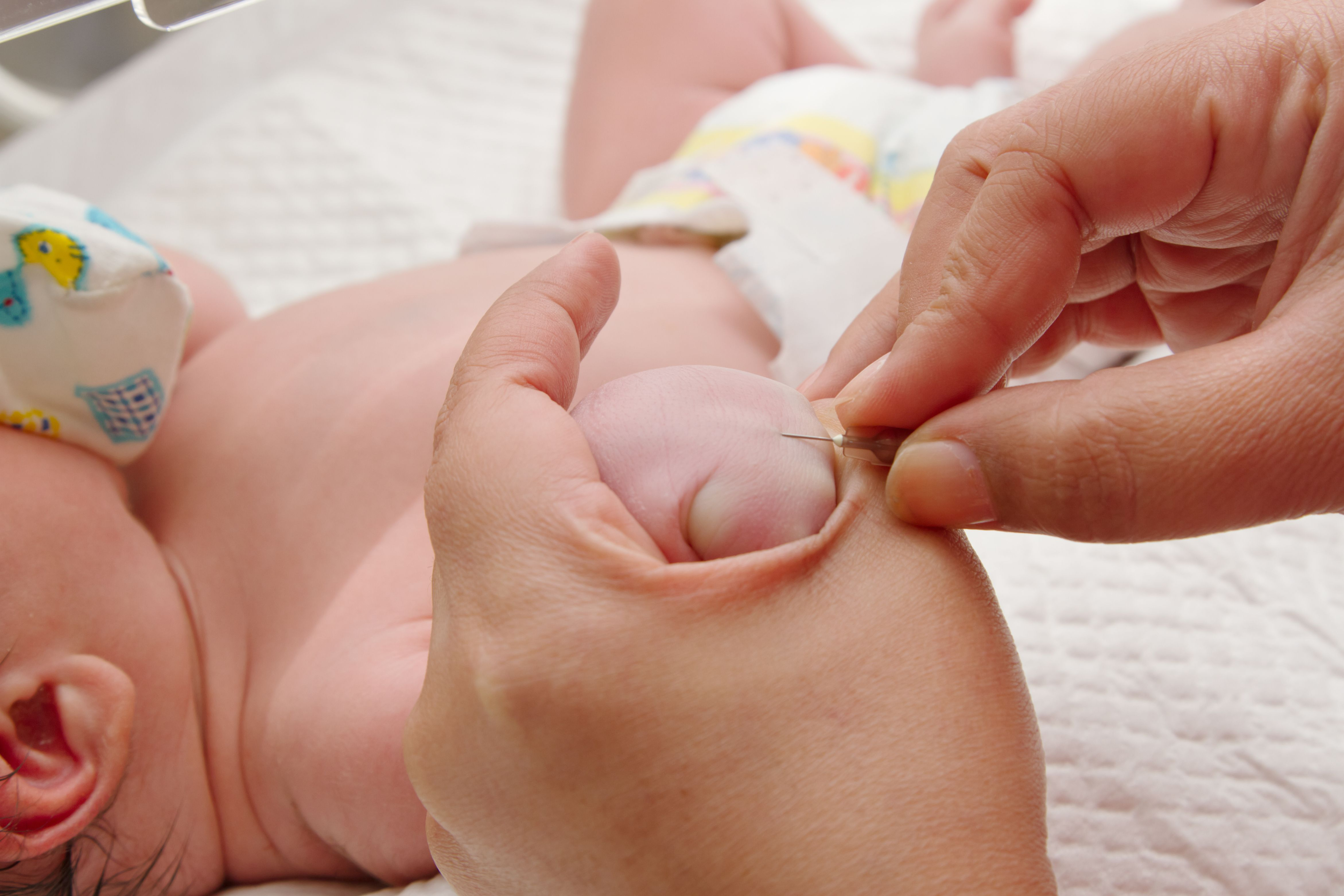 မွေးကင်းစနှင့် ကလေးငယ်လေးတွေမှာ လေဖြတ်ခြင်းကို ဘယ်လိုစစ်ဆေးတွေ့ရှိနိုင်မလဲ