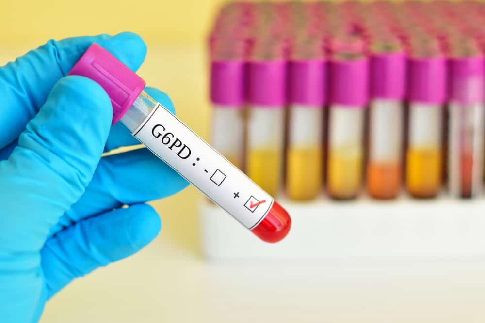 G6PD နည်းပါးတဲ့ရောဂါ (G6PD deficiency) ဆိုတာ…..