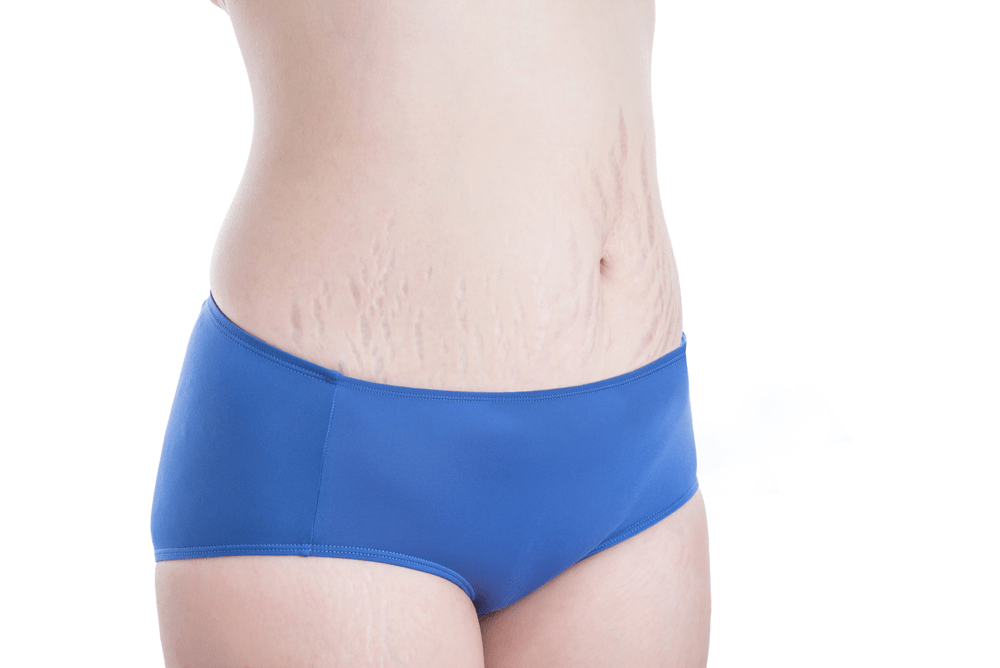 áĄááźáąáŹááźááşááŹáá˝áą ááŤá¸áá˝áŹá¸áĄáąáŹááş áá°ááŽááąá¸áááˇáş áá°áá˛ááąáŹááşá¸(á
)ááąáŹáş