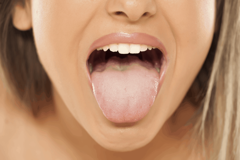 white-tongue