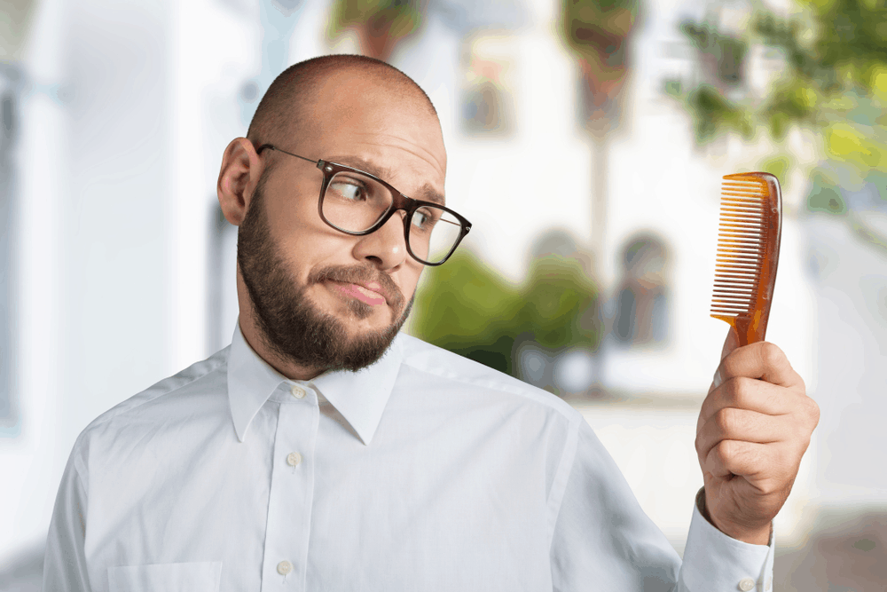 testosterone-and-male-balding