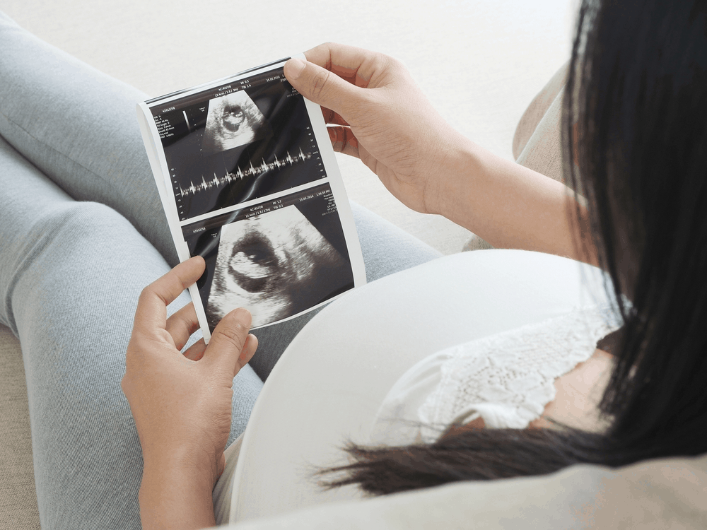 ultrasound-a-trimester-by-trimester-guide