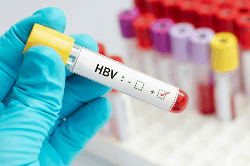 pregnant-women-with-hepatitis