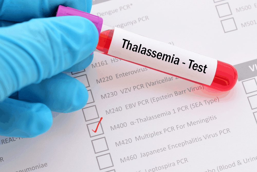 thalassemia-%e1%80%9b%e1%80%b1%e1%80%ac%e1%80%82%e1%80%ab-%e1%80%94%e1%80%be%e1%80%84%e1%80%b7%e1%80%ba-%e1%80%a1%e1%80%ac%e1%80%9f%e1%80%ac%e1%80%9b