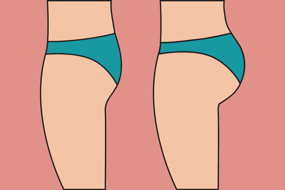 ပြားချပ်ချပ် တင်ပါးလေးကို ဘယ်လိုပုံပြန်သွင်းမလဲ