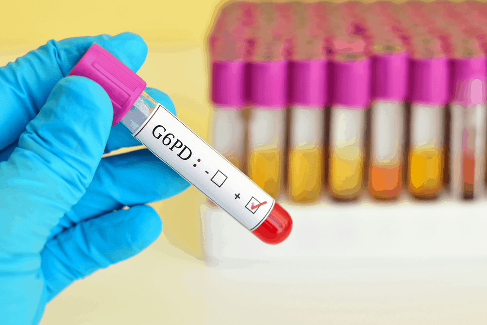 G6PD ရောဂါရှိတဲ့ ကလေးတစ်ယောက်ကို ဘယ်လိုပြုစုမလဲ ။ ။