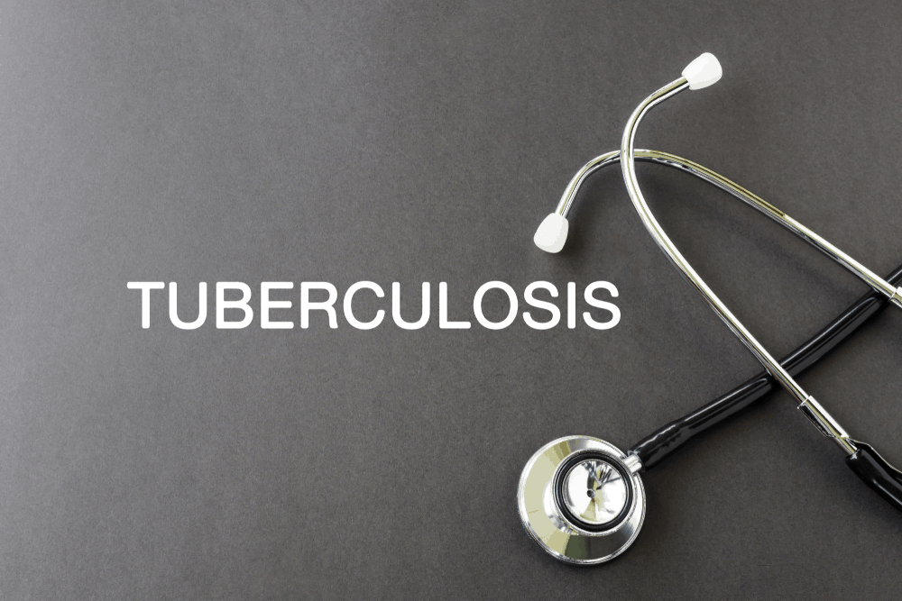 tb-that-des-not-lung-tb