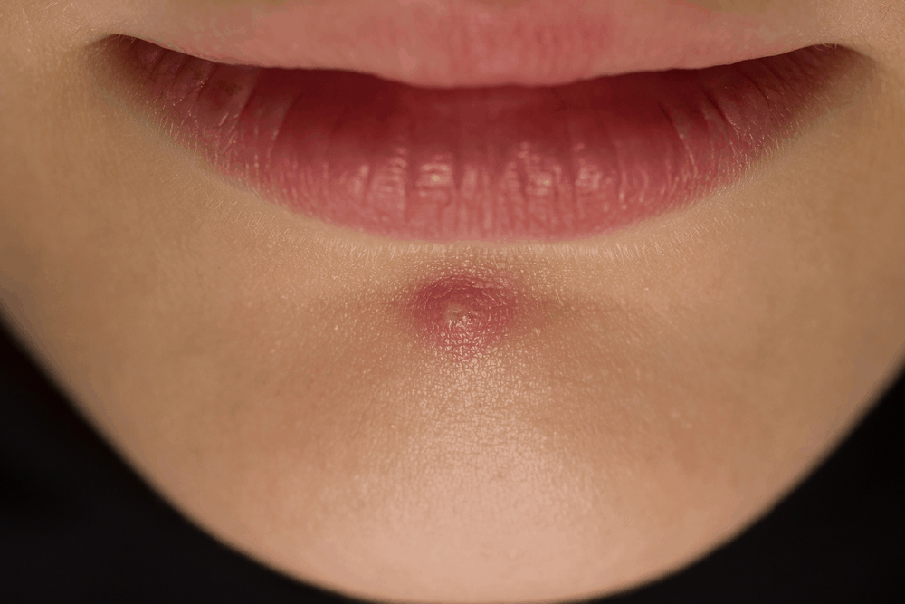 %e1%80%b1%e1%80%99%e1%80%b8%e1%80%b1%e1%80%85%e1%80%b7%e1%80%99%e1%80%bd%e1%80%ac-%e1%80%9d%e1%80%80%e1%80%b9%e1%80%bb%e1%80%81%e1%80%b6%e1%80%b1%e1%80%95%e1%80%ab%e1%80%80%e1%80%b9%e1%80%9b%e1%80%90