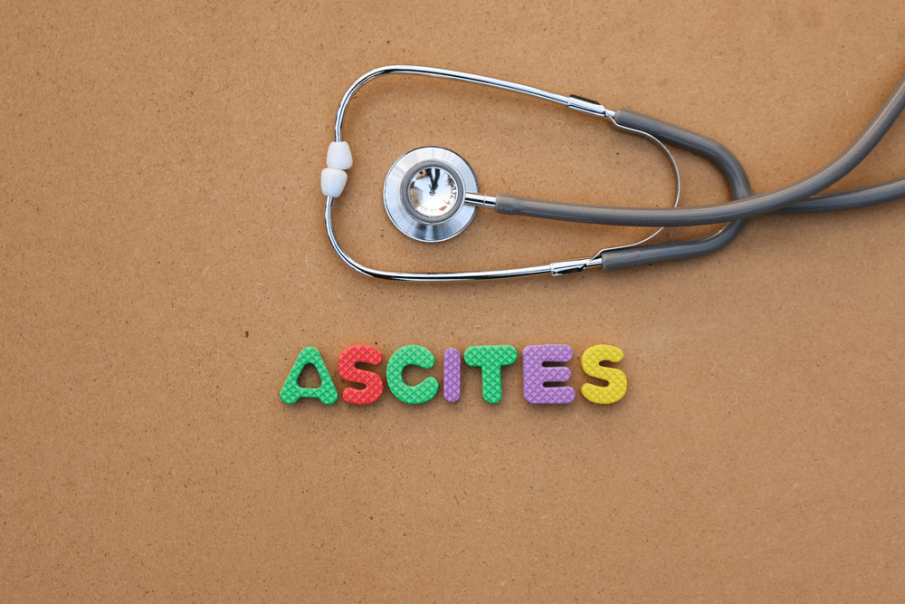 ရေဖျဉ်းရှိသူတွေအတွက် သတိထားသင့်တဲ့အချက်တွေ