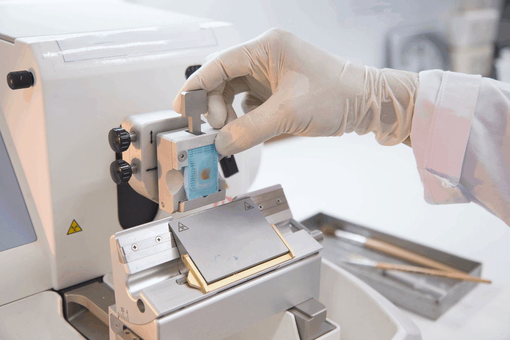 အသားစယူ စစ်ဆေးခြင်း(Biopsy) နဲ့ပတ်သက်ပြီး ဘာတွေသိထားသင့်သလဲ