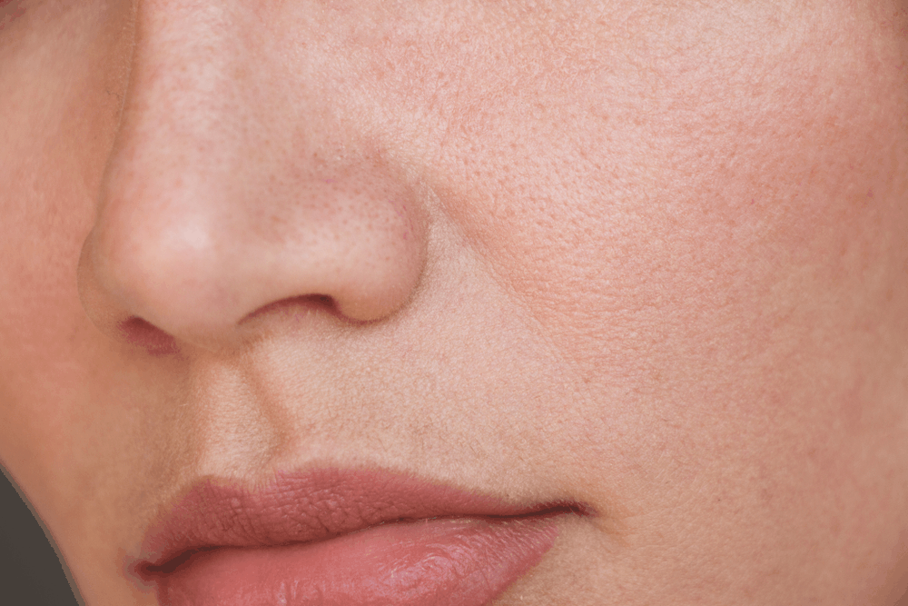 how-to-minimize-and-shrink-pores