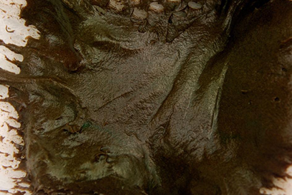 စေးကပ်သော အစိမ်းပုပ်ရောင် ဝမ်း