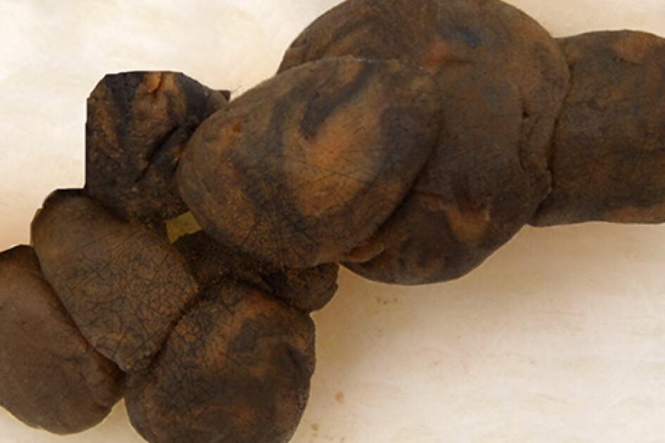 ခြောက်သွေ့ပြီး မာကျစ်သော အညိုရောင်ဝမ်း