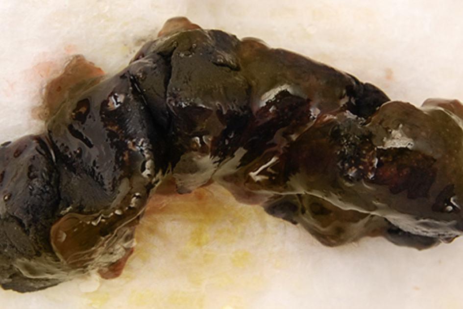 အမည်းရောင် ဝမ်း