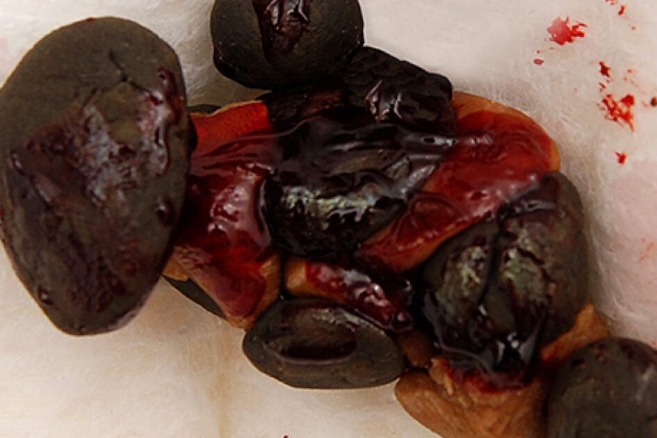 အနီရောင်စွက်နေသော ဝမ်း