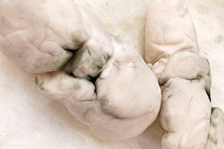 အဖြူရောင်ဝမ်း