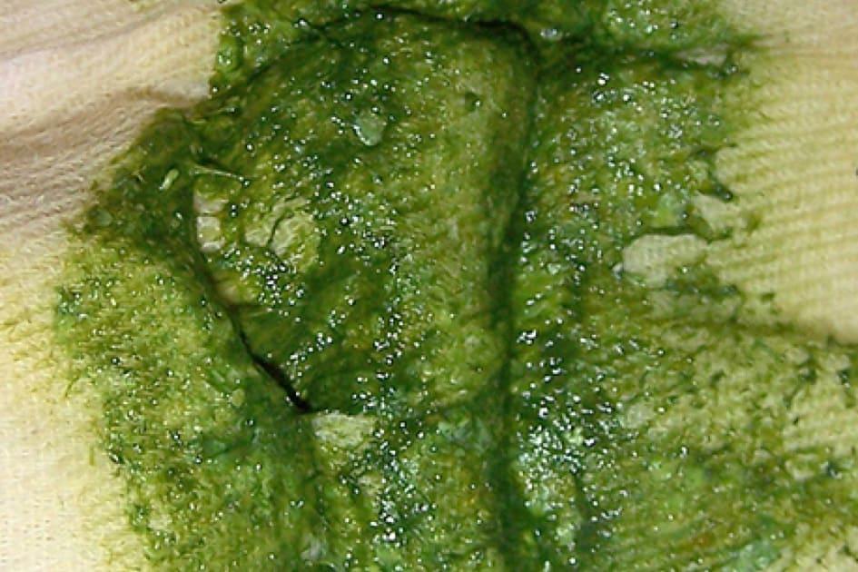 အစိမ်းရောင် ဝမ်း