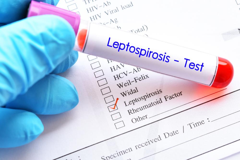 Leptospirosis ရောဂါအကြောင်း