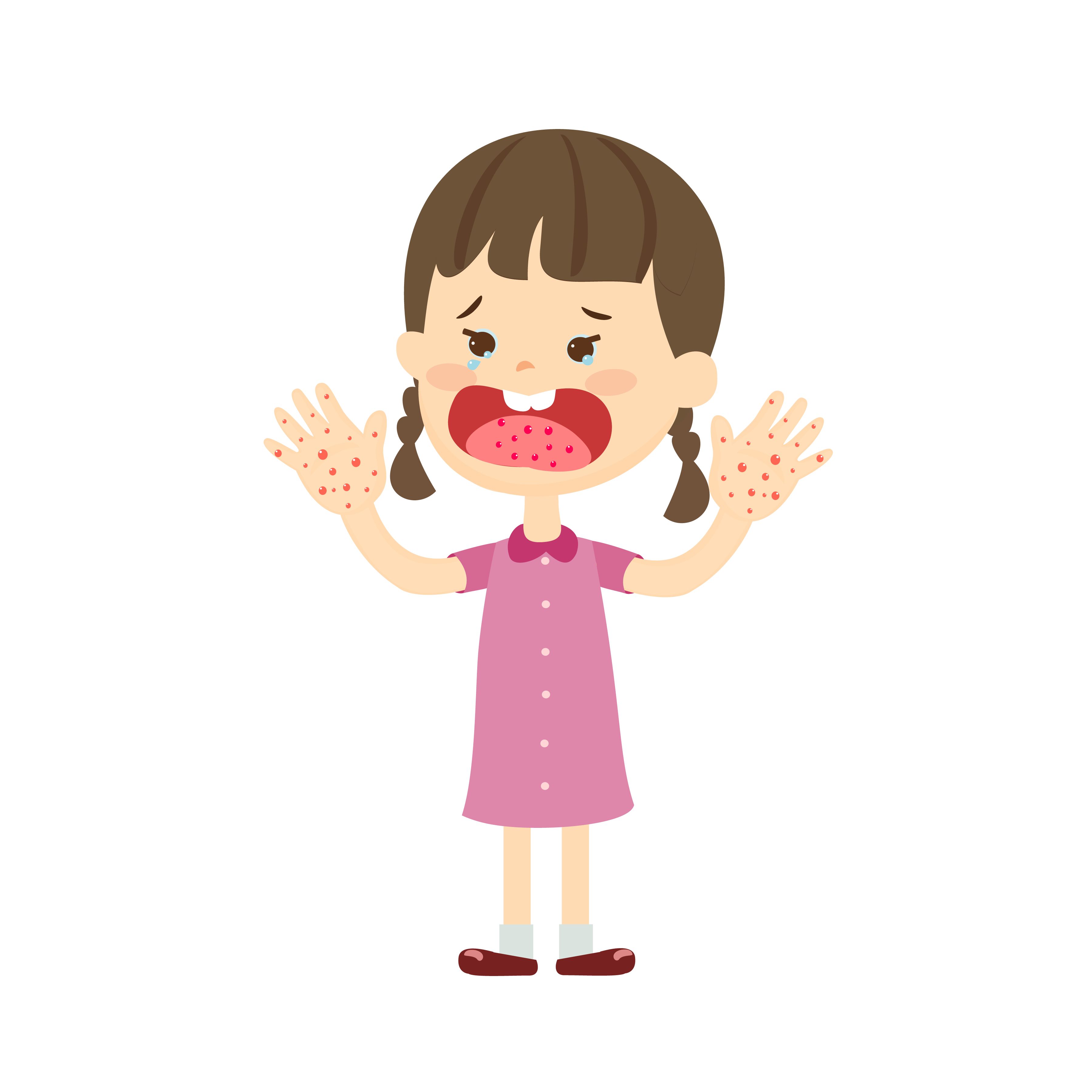 Hand Foot Mouth ရောဂါ စိုးရိမ်ရလား