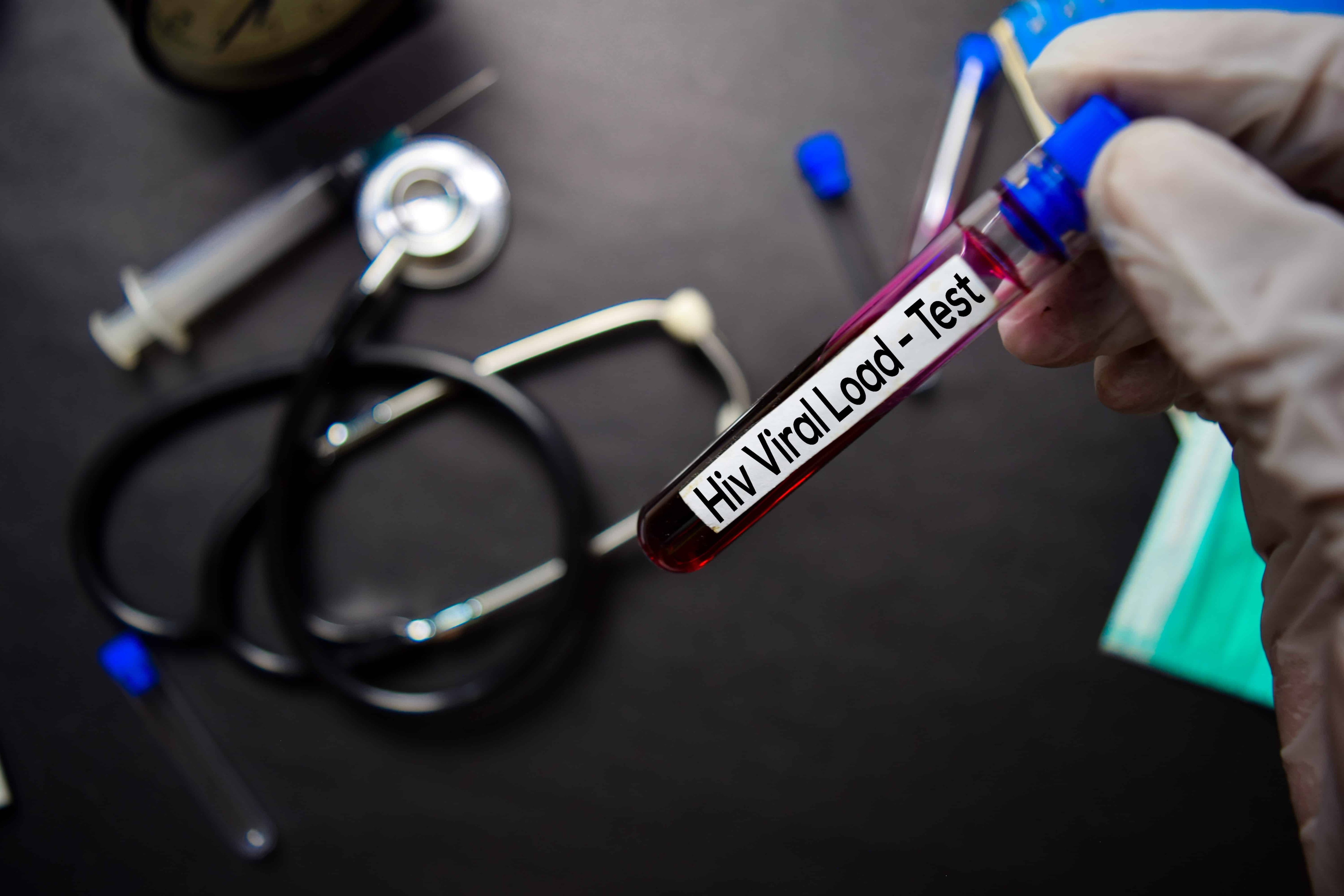 သွေးထဲက HIV ပိုးကောင်ရေပမာဏကို စစ်ဆေးခြင်း (HIV Viral Load)