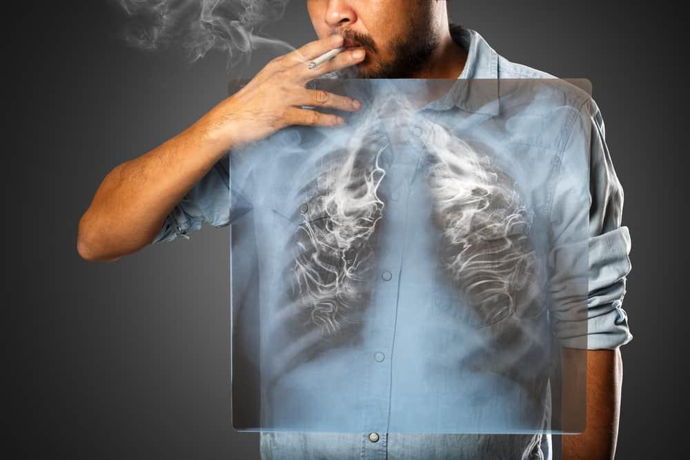 facts-should-know-about-lung-cancer