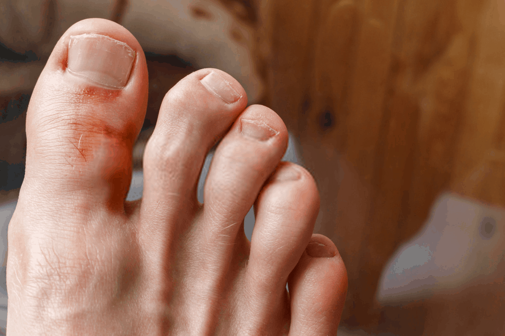 %e1%80%82%e1%80%b1%e1%80%ab%e1%80%80%e1%80%ba%e1%80%9b%e1%80%b1%e1%80%ac%e1%80%82%e1%80%ab-%e1%80%a1%e1%80%86%e1%80%85%e1%80%ba%e1%80%94%e1%80%ac%e1%80%9e%e1%80%99%e1%80%ac%e1%80%b8%e1%80%90%e1%80%bd