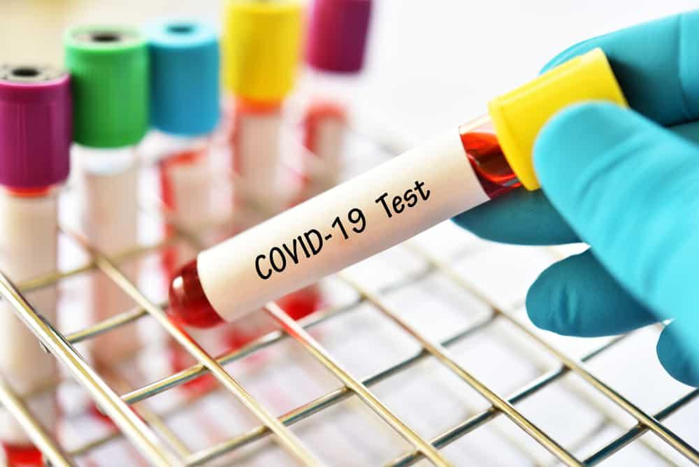 coronavirus-top-targets-men-seniors-smokers