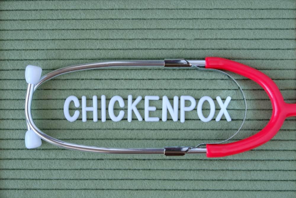 ရေကျောက်ပေါက်ခြင်း (Chicken Pox in children )