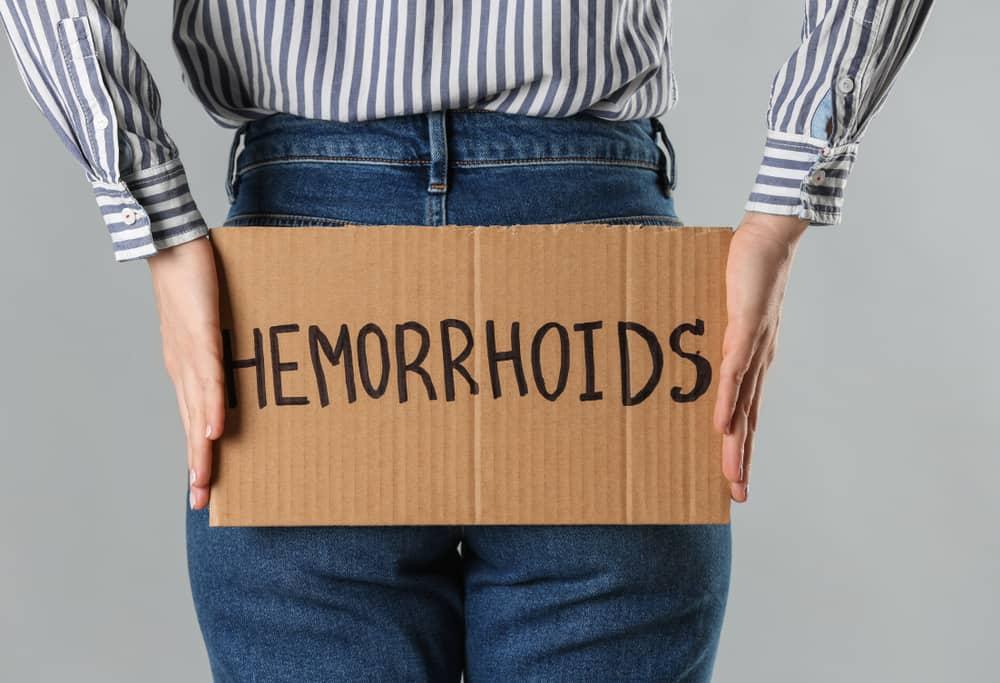 hemorrhoids