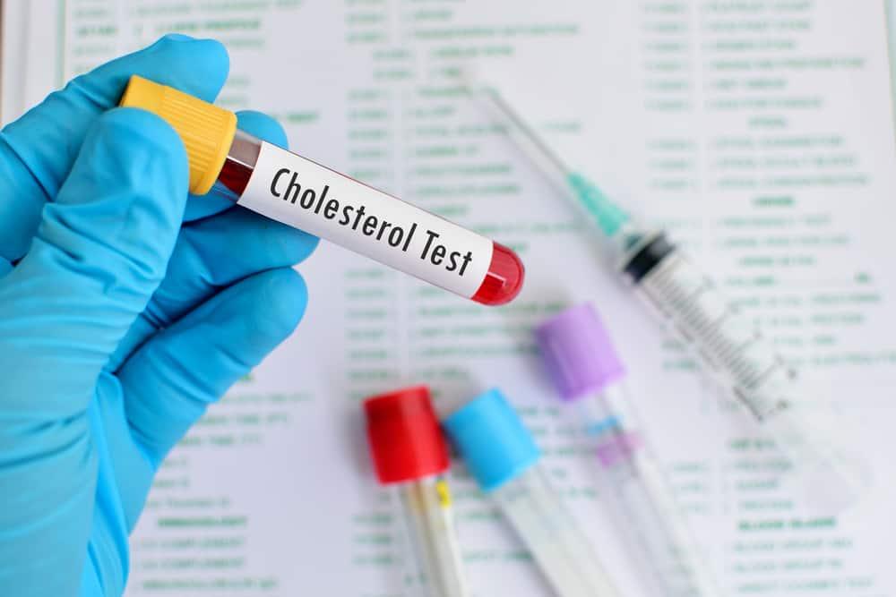cholesterol-effects-on-body