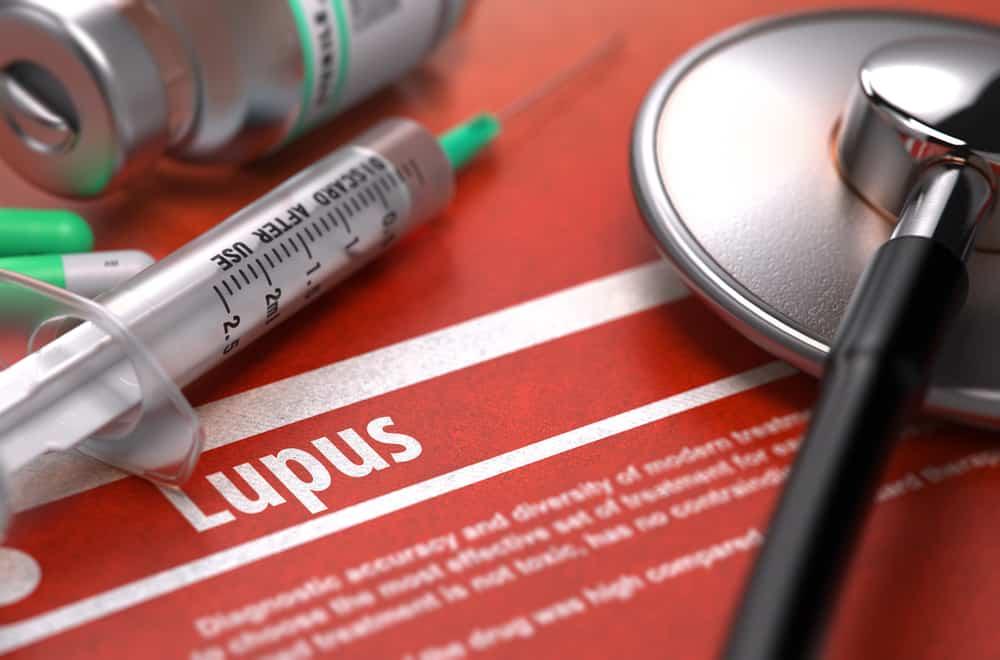 Lupus (သို့မဟုတ်) အမျိုးသမီးတွေ သတိထားသင့်တဲ့ နာတာရှည်ရောင်ရမ်းနာ