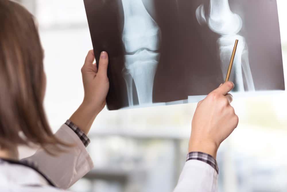 osteoarthritis-complications-and-dangers