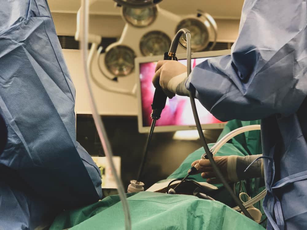 gallbladder-removal-side-effects