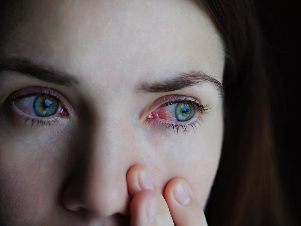 is-pink-eye-a-symptom-of-covid-19