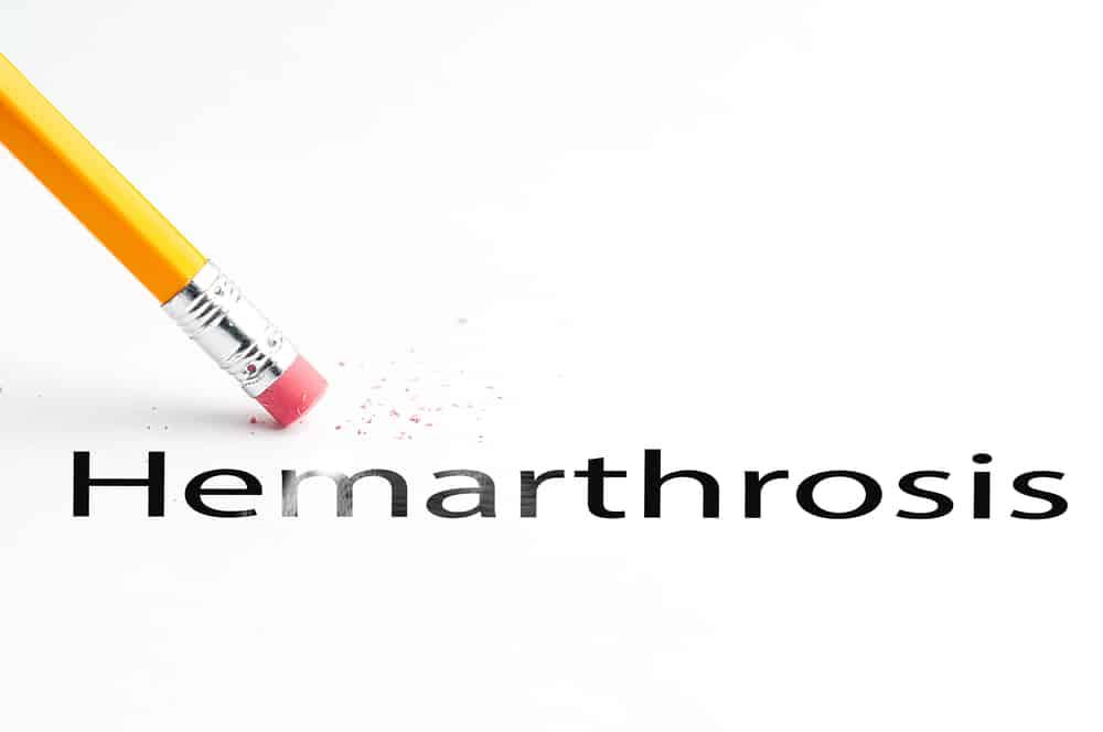 hemarthrosis